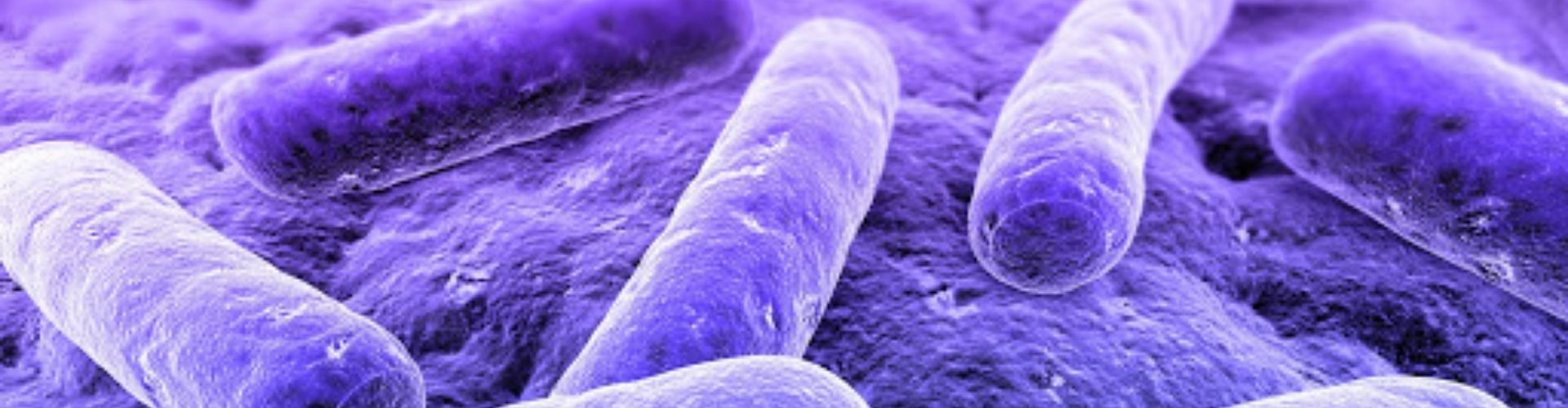 Servicio de control de Legionella en Marchena
